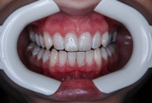 zdrowe zęby, dentysta