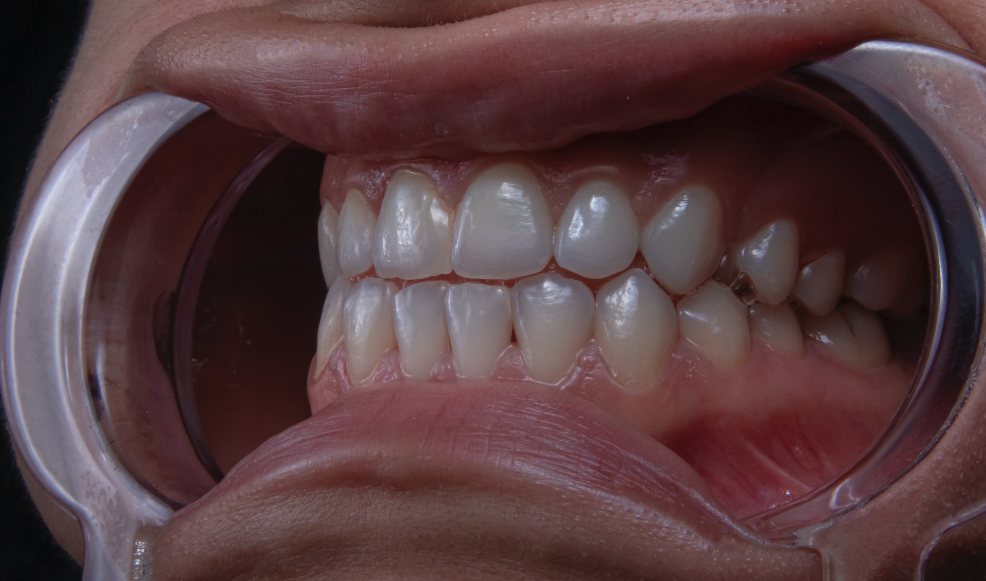 zdrowe zęby, dentysta