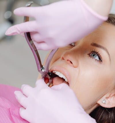 Korona porcelanowa na zębie martwym – czy to dobre rozwiązanie?