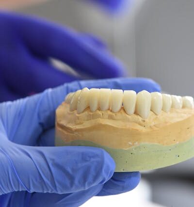 Czy protezy ruchome acetalowe uczulają?