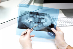 Jak często można wykonywać RTG zębów?