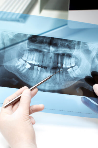 Jak często można wykonywać RTG zębów?