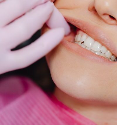 Jakie badania wykonuje periodontolog przed rozpoczęciem leczenia?
