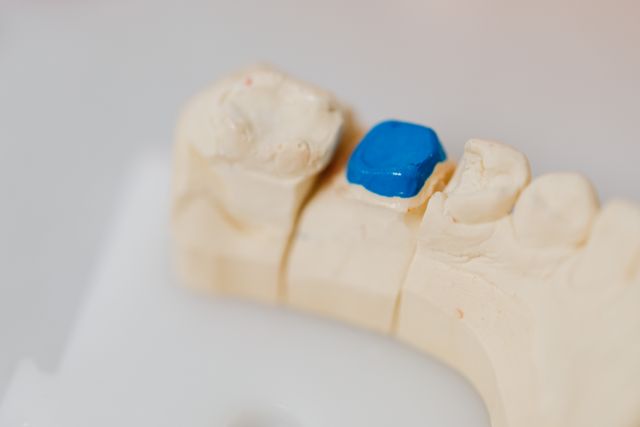 Jak rozpoznać pierwsze objawy zapalenia wokół implantu?